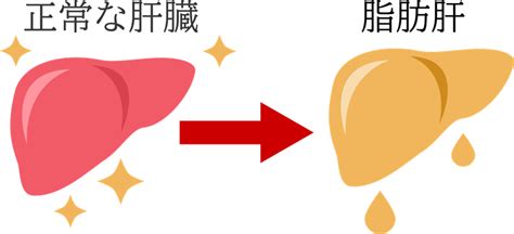 脂肪肝から慢性肝炎になる症状･原因･治療法│長良内科クリニック