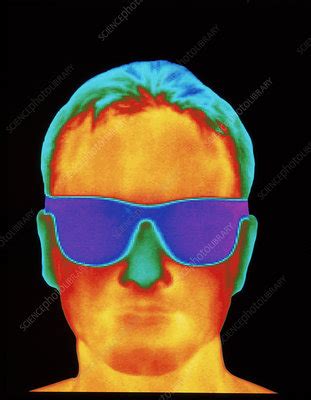 Thermogram Of The Front View Of A Man S H Stock Image P