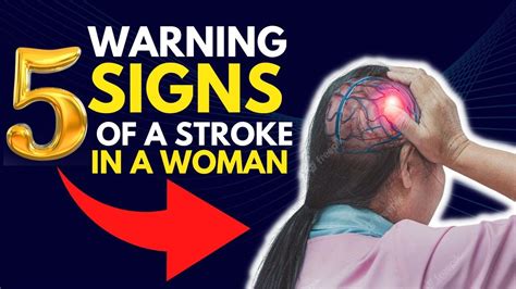 What Are The 5 Warning Signs Of A Stroke In A Woman Youtube