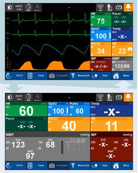 D Fibrillateur Professionnel Schiller Touch Formamed