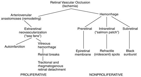 Sickle cell retinopathy - American Academy of Ophthalmology