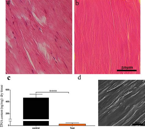 Human Tendon Decellularization H E Images Of Native Human Tendon A