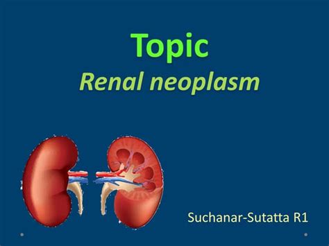 Renal mass | PPT