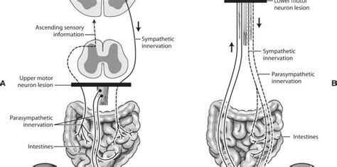 lower motor neuron lesion symptoms | Science online