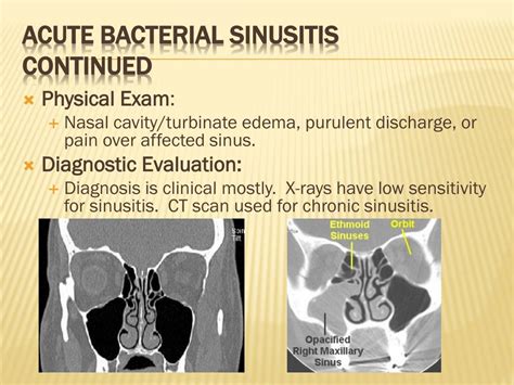 Ppt Otorhinolaryngology Disorders Of The Ear Nose And Throat