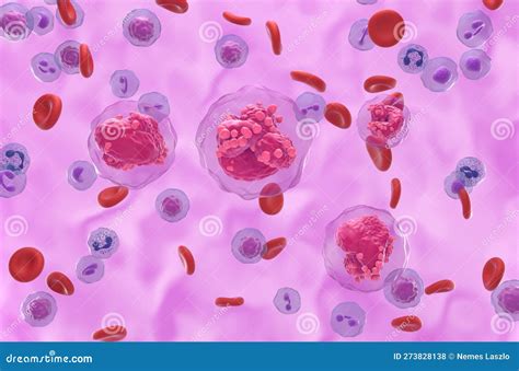 Leucemia Linfoblástica Aguda Todas Las Células Cancerosas En La Visión Isométrica Del Flujo