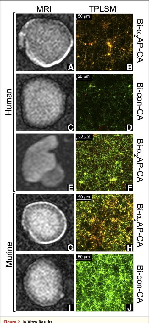 Figure From Molecular Mri Of Early Thrombus Formation Using A Bimodal