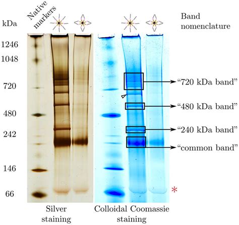 Electrophoresis Of Colloids