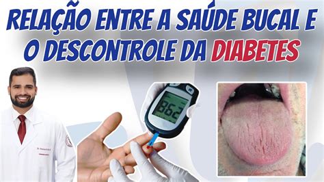 Doen A Periodontal E Diabetes Descontrolada Saiba A Rela O E Efeitos