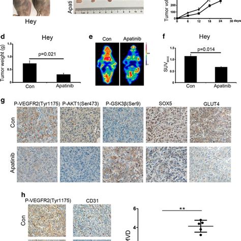 Apatinib Inhibits In Vivo Proliferation And Glycolysis Of Ovarian