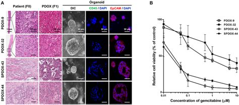 Correlation Of Drug Sensitivity Between Pdox Derived Organoids And