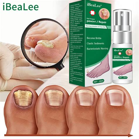 Ibea Lee Nail Fungus Treatment Essence Serum Hand Care Foot Fungal