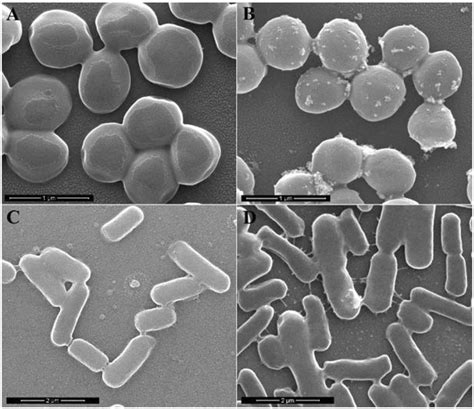 Sem Images Of S Aureus A B And E Coli C D Before A C And After