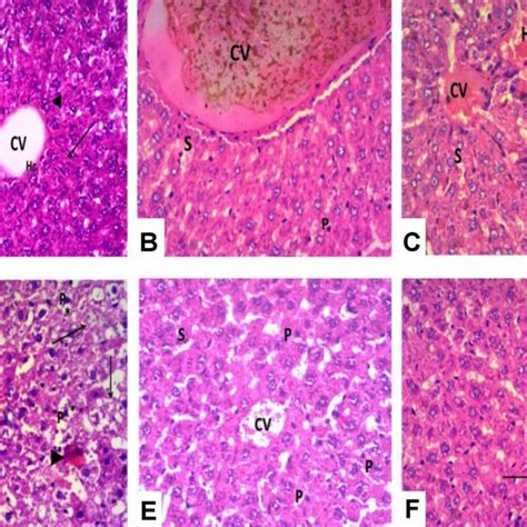 Photomicrograph Of Massons Trichrome Stained Liver Sections Of The Download Scientific Diagram