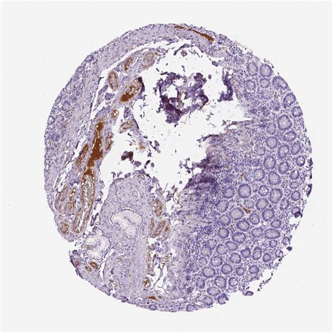 Tissue Expression Of Apoe Staining In Duodenum The Human Protein Atlas