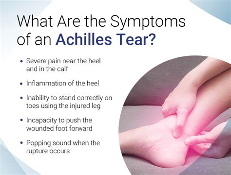 Achilles Tendon Tear in Houston, TX