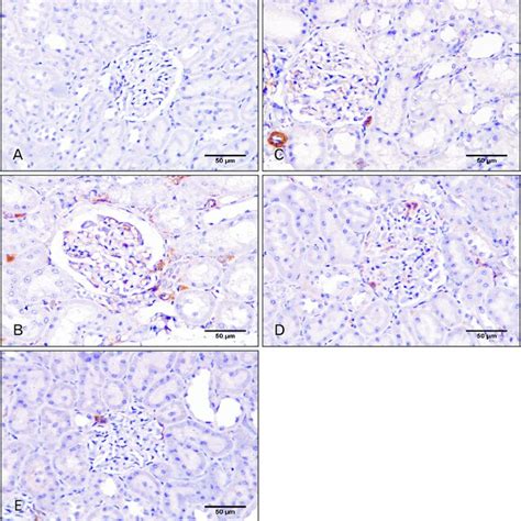 Representative Photomicro Graphs Of Kidney Sections Stained With H E