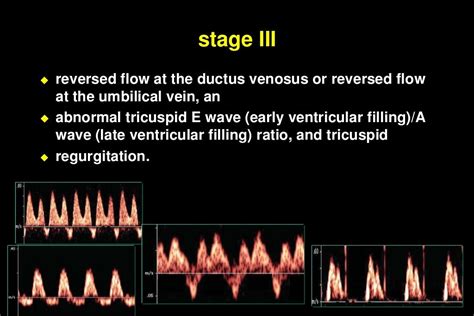 Color doppler in fetal hypoxia