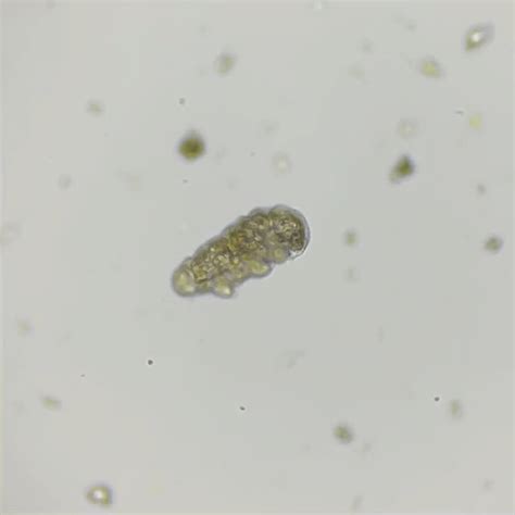 [OC] Finally found this guy under microscope. Yes tardigrades are cute ...