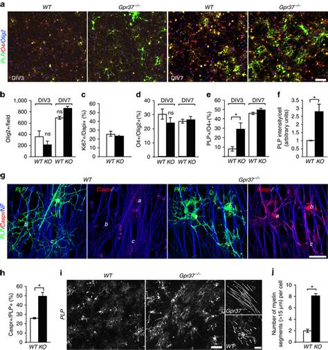 Absence Of Gpr37 Results In Faster Differentiation Of Oligodendrocytes