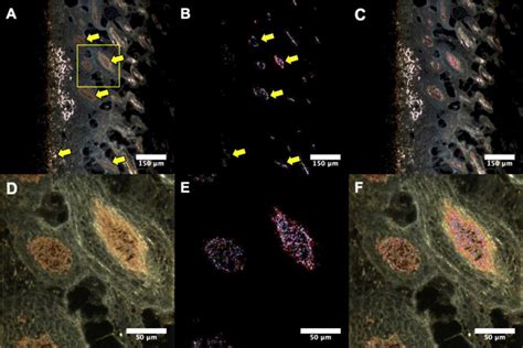 Hyperspectral Microscopy Of Subcutaneously Released Silver Nanoparticles Reveals Sex Differences