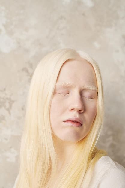 Jeune Femme Albinos à La Peau Pâle Et Aux Cheveux Très Clairs Gardant Les Yeux Fermés Photo