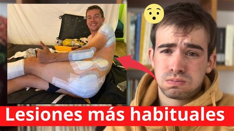 Las LESIONES MÁS FRECUENTES en el CICLISMO PROFESIONAL YouTube