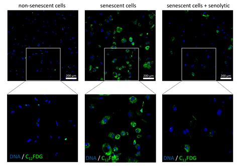 Beta Galactosidase Staining