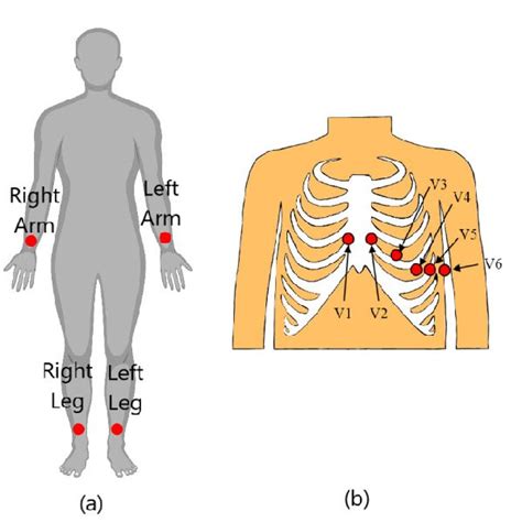 Possible electrode placements for ECG recordings [19]: (a) electrode... | Download Scientific ...