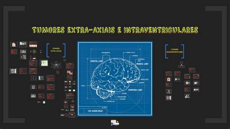 Ausencia De Coleções Extra Axiais - TUMORES EXTRA-AXIAIS E INTRAVENTRICULARES by Karla Oliveira on Prezi