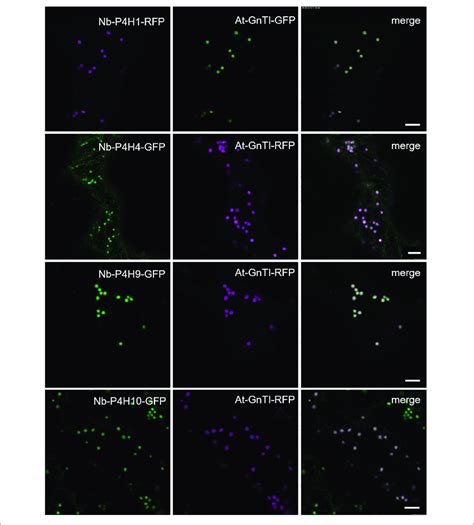 Subcellular Localization Of Potential Nicotiana Benthamiana P4hs