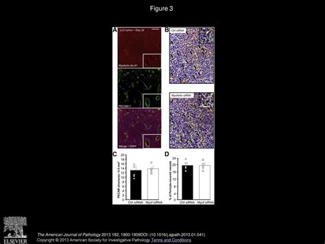 Expression Of Myoferlin In Human And Murine Carcinoma Tumors Ppt Download