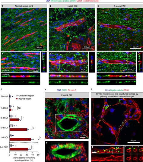 Microvascular Endothelial Cells Engulf Myelin Debris And Promote