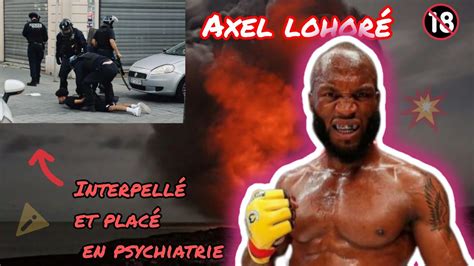 Alex Lohor Interpell Et Plac En Psychiatrie Youtube