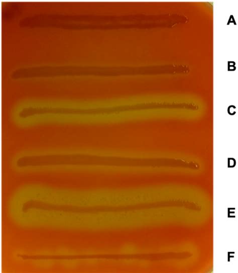 Figure From Genetics Toxicity And Distribution Of Enterohemorrhagic