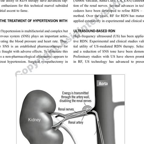 The Concept Of Catheter Based Renal Denervation Download Scientific Diagram