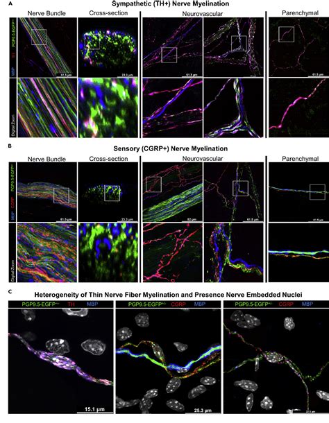 Figure From Schwann Cells Contribute To Demyelinating Diabetic