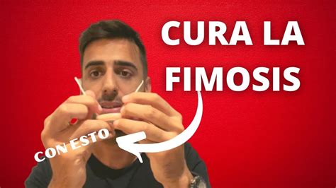 Tratamiento Casero Y Natural Para Curar La Fimosis Sin Circuncisi N