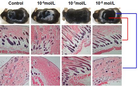 Frontiers Dihydrotestosterone Regulates Hair Growth Through The Wnt