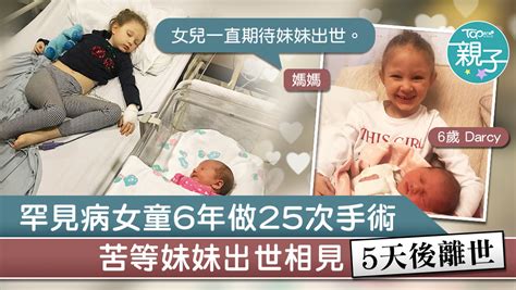 【姊妹情深】6歲罕見病女童做過25次手術 苦等妹妹出世相見5天後離世 香港經濟日報 Topick 親子 親子資訊 D191009