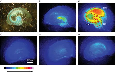 Figure 1 from The use of Organotypic Hippocampal Slice Cultures to ... 