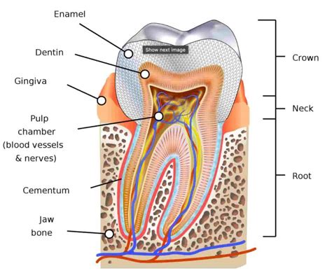 Abfraction Lesion What It Is Causes Treatments Longevita Dental