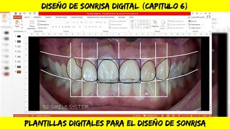 PLANTILLAS Diseño de Sonrisa Digital POWER POINT Cap 6 YouTube