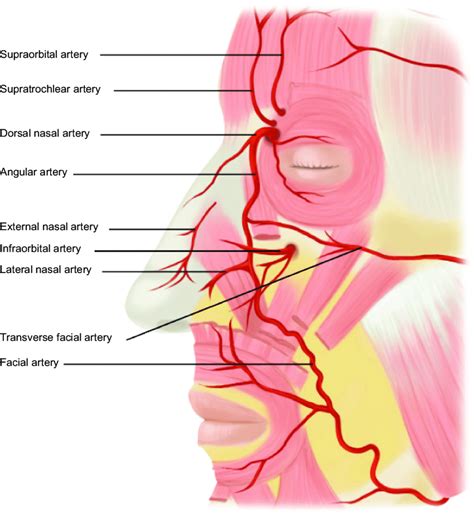 List 99 Pictures Vascular Occlusion Lip Filler Pictures Superb