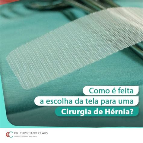 Como é feita a escolha da tela para uma cirurgia de hérnia Dr