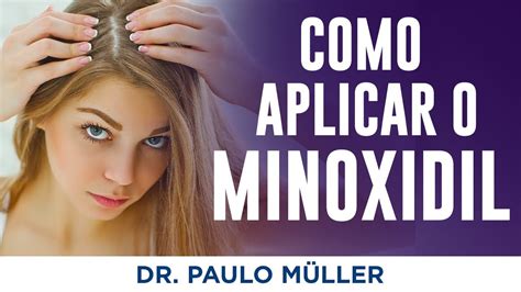 Como Aplicar O Minoxidil Corretamente Dr Paulo M Ller Dermatologista