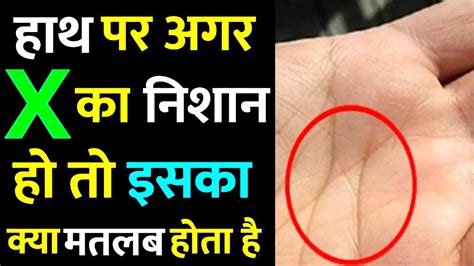 हाथ पर X के निशान का मतलब क्या होता है What Does Letter X On Your Palms Reveal Video