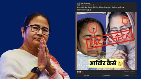 Fact Check Mamata Banerjees Viral Image Showing A Bandage On Her Forehead Is Not Fake But