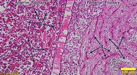 Anterior Pituitary Histology