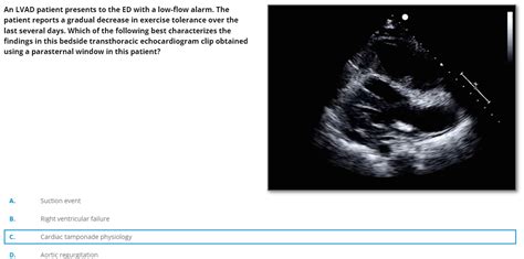 An LVAD Patient Presents To The ED With A Low Flow Chegg